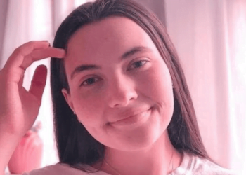 Joven es alérgica al agua y a sus propias lágrimas