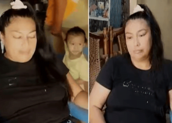 Diagnostican extraña enfermedad a mujer que suda sangre por diversas partes del cuerpo