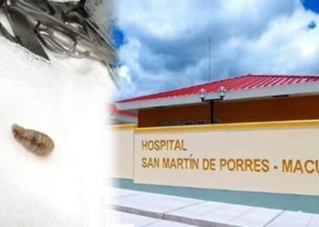 Gestante acude al hospital por dolor y médicos le extraen un gusano vivo del cuerpo