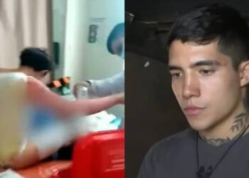Lima: joven de 24 años sufre quemaduras tras la explosión de su celular