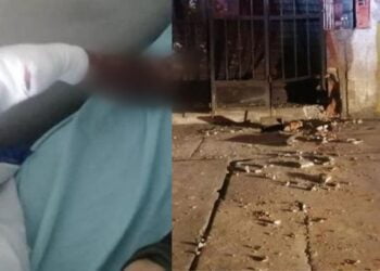 Extorsionador pierde varios dedos de la mano tras manipular artefacto explosivo