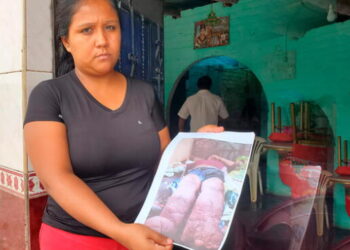 Joven sufre extraña enfermedad que ha hinchado sus piernas extremadamente