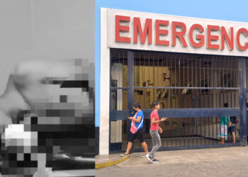 Trujillo: extranjero se vuela la mano con dinamita tras intentar extorsionar a familia