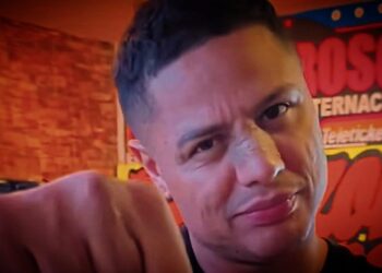 Jonathan Maicelo confirma que se operó la nariz: “Mi ñata estaba mal”