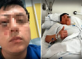 España: joven peruano en Madrid casi pierde un ojo tras brutal agresión xenófoba en estación de tren